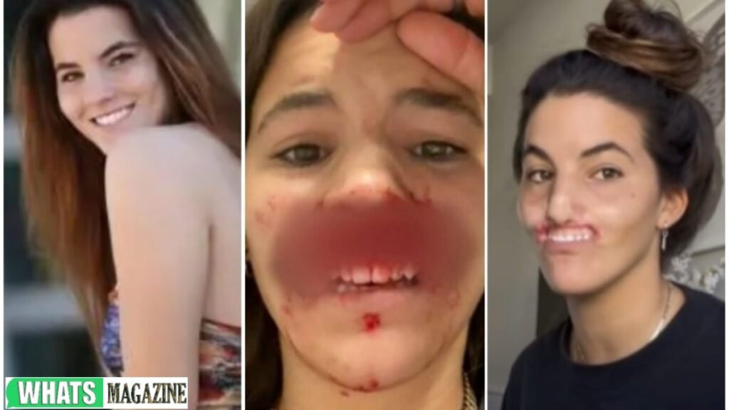 Brooklinn Khoury photo after pitbull attack