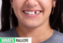 The Challenges and Solutions of Living With a Missing Front Tooth