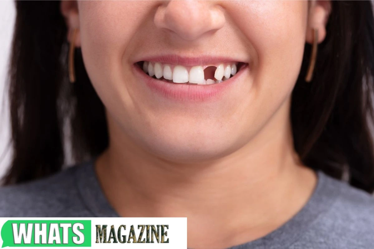 The Challenges and Solutions of Living With a Missing Front Tooth