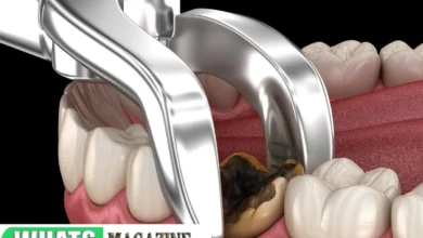 Emergency Dental Extraction