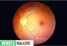 Healthy Retina vs. an Unhealthy Retina Signs You Might Have a Retinal Disease