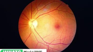 Healthy Retina vs. an Unhealthy Retina Signs You Might Have a Retinal Disease