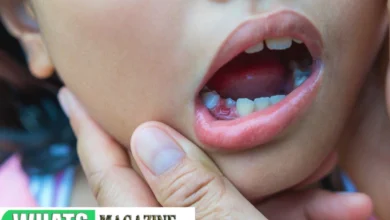 Avoid After Tooth Extraction