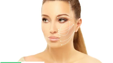 Surgical Face and Neck Lifting